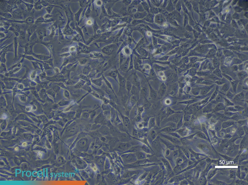 Human Cardiac Microvascular Endothelial (Primary cell immortalization) Cell Complete Medium - 5