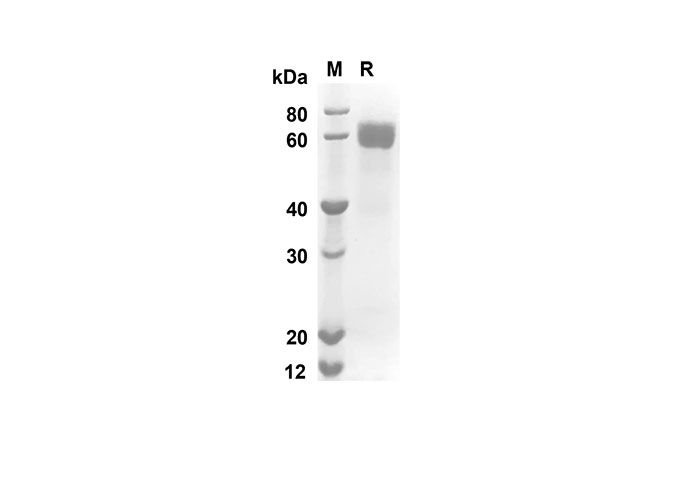 Recombinant Mouse PDGF-BB Protein(Sumo Tag)-产品推荐-1