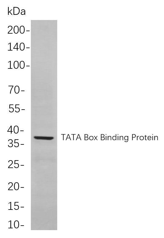 Recombinant TATA Box Binding Protein Monoclonal Antibody-searchlist-1