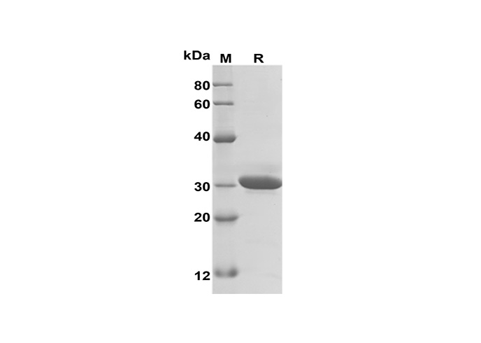 Recombinant Rat IL-17A Protein(hIgG1 Fc Tag)-产品推荐-1
