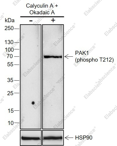 Recombinant Phospho-PAK1 (Thr212) Monoclonal Antibody - 1