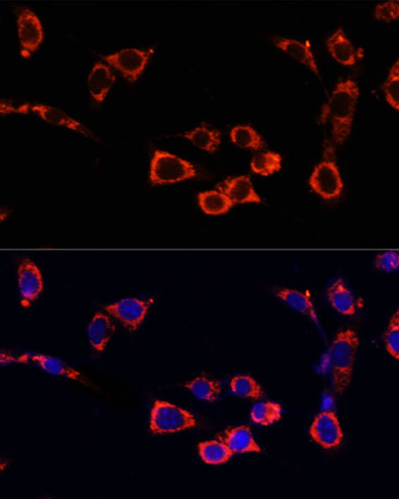 Immunofluorescence analysis of NIH/3T3 cells using mTOR Polyclonal Antibody at dilution of 1:100. Blue: DAPI for nuclear staining.
