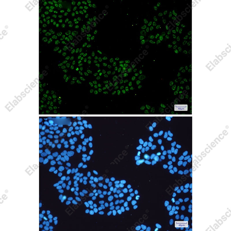 Recombinant KDM4B/JMJD2B Monoclonal Antibody - 3