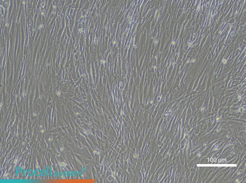 Human Pulmonary Arteriolar Smooth Muscle Cell Complete Medium - 2