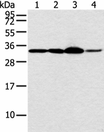 Western blot analysis of Hela and PC3 cell 231 cell and human esophagus cancer tissue  using MED6 Polyclonal Antibody at dilution of 1:400