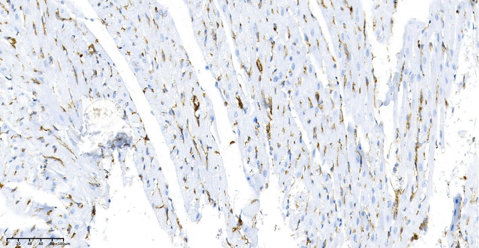 Recombinant α smooth muscle actin Monoclonal Antibody - small - 2