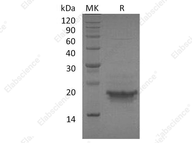 Recombinant Human CD98 Protein (His Tag) - 1