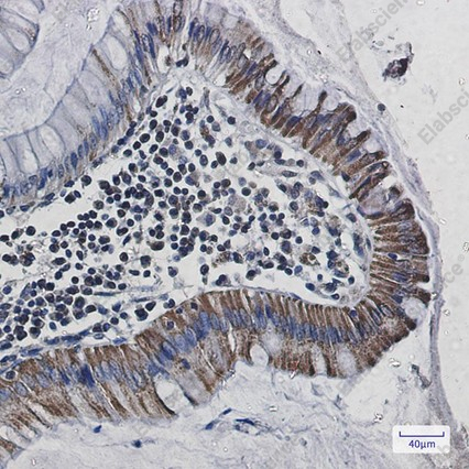 Recombinant Cytochrome C Oxidase subunit Vic Monoclonal Antibody - 4