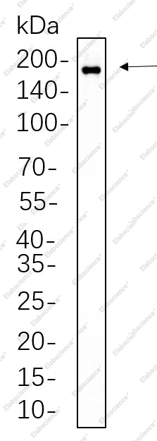 Recombinant Phospho-HER2 (Tyr1221, 1222) Monoclonal Antibody - 1