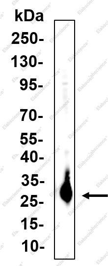 Recombinant N-RAS (mutated Q61R) Monoclonal Antibody - 1