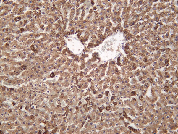 Recombinant GOT2 Monoclonal Antibody - 2