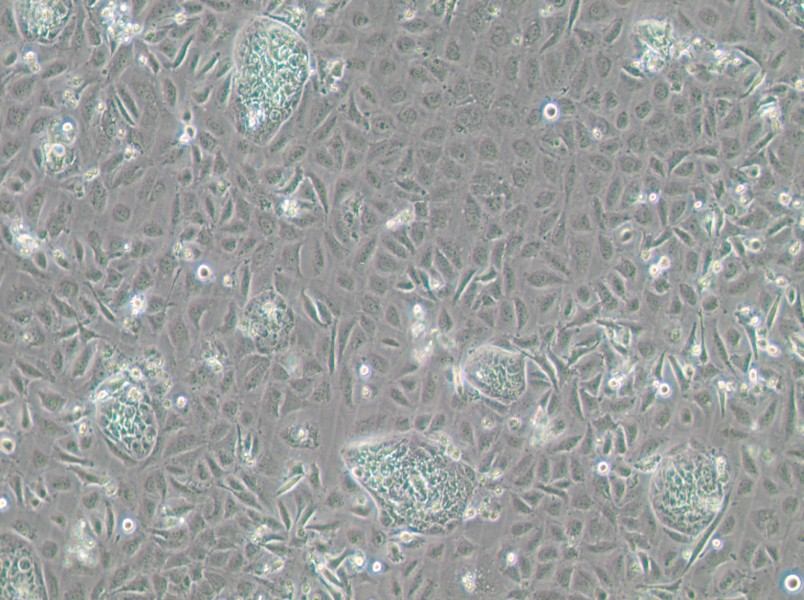 TR-LCC-1 Cell Complete Medium - 3