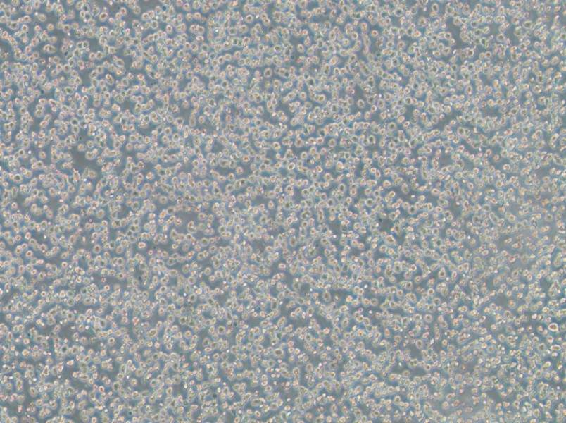 OPM2 Cell Complete Medium-searchlist-1