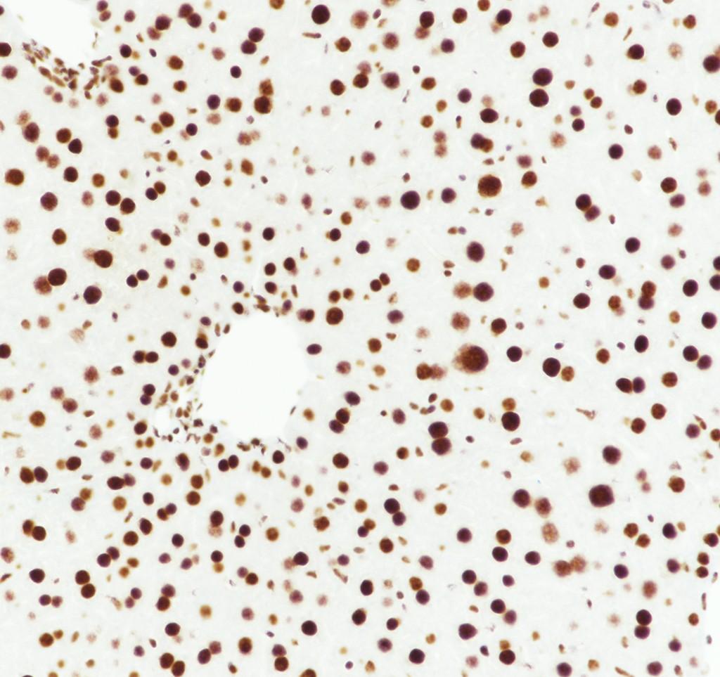 Recombinant U2AF2 Monoclonal Antibody - 3