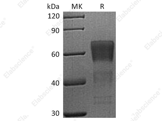 Recombinant Human CD28/TP44 Protein (mFc Tag) - 1