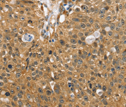 SORT1 Polyclonal Antibody - 3