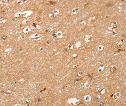 Immunohistochemistry of paraffin-embedded Human brain  tissue using RASA3 Polyclonal Antibody at dilution 1:35