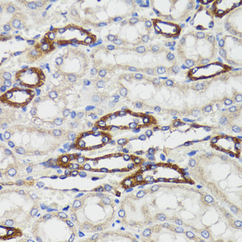 Immunohistochemistry of paraffin-embedded rat kidney using BCAP29 Polyclonal Antibody at dilution of 1:100 (40x lens).Perform microwave antigen retrieval with 10 mM PBS buffer pH 7.2 before commencing with IHC staining protocol.