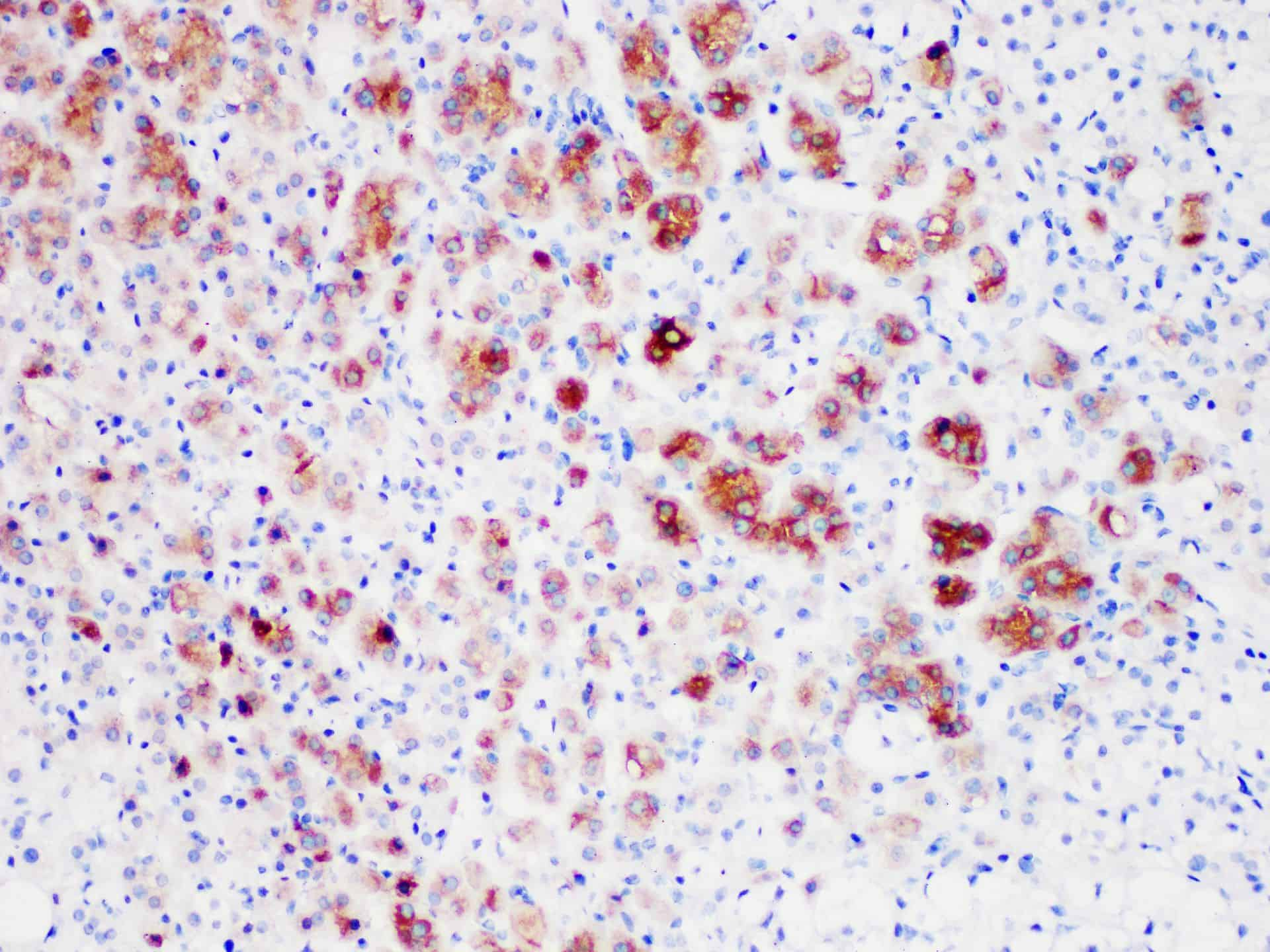 Immunohistochemistry of paraffinembedded Human testicular tissue with Inhibin,alpha Monoclonal Antibody(Antigen repaired by EDTA).