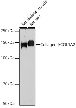 Western blot analysis of extracts of various cell lines using Collagen I/COL1A2 Polyclonal Antibody at 1:1000 dilution.