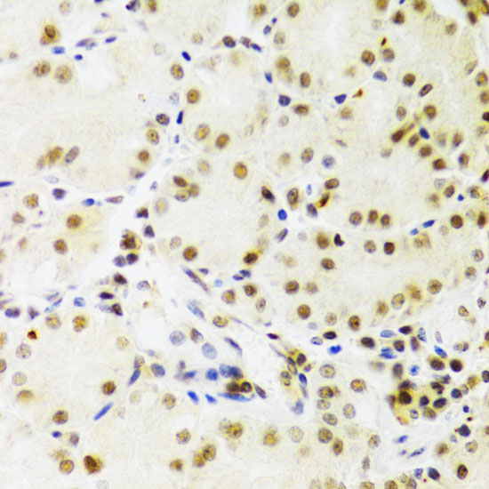 Immunohistochemistry of paraffin-embedded Human stomach using PRPF3 Polyclonal Antibody at dilution of 1:100 (40x lens).