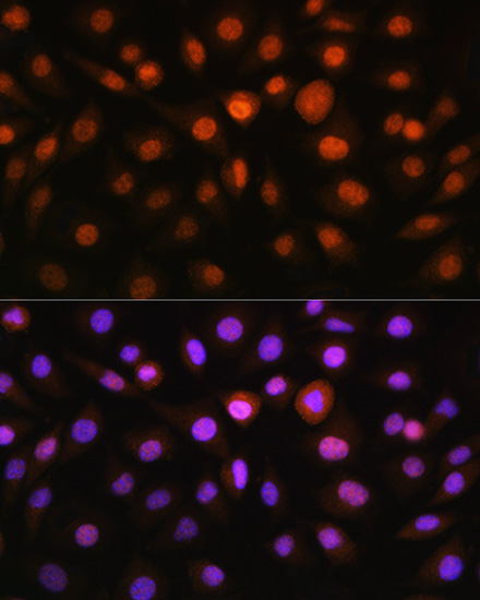 Immunofluorescence analysis of L929 cells using DDIT3/CHOP Polyclonal Antibody at dilution of 1:100. Blue: DAPI for nuclear staining.