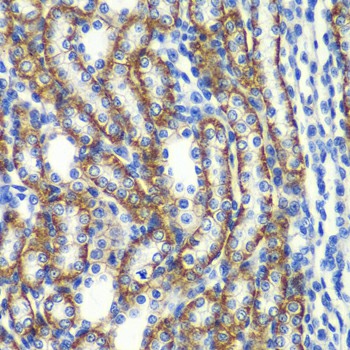 Immunohistochemistry of paraffin-embedded rat kidney using ZFAND3 Polyclonal Antibody at dilution of 1:100 (40x lens).Perform microwave antigen retrieval with 10 mM PBS buffer pH 7.2 before commencing with IHC staining protocol.