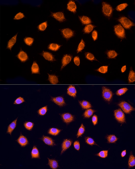 Immunofluorescence analysis of L929 cells using RPH3AL Polyclonal Antibody at dilution of 100 (40x lens). Blue: DAPI for nuclear staining.