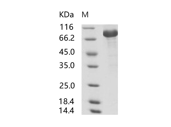 Immobilized human ACE2 protein (Fc tag)(PKSH031870) at 2ug/mL (100uL/well) can bind Recombinant SARS-CoV S1 Protein (His Tag) (Active) (PKSV030101), the EC50 of SARS-CoV S1 Protein (His Tag) (Active) (PKSV030101) is 400-850 ng/mL.