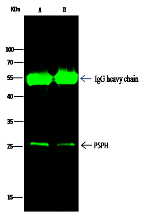 Recombinant PSPH Monoclonal Antibody