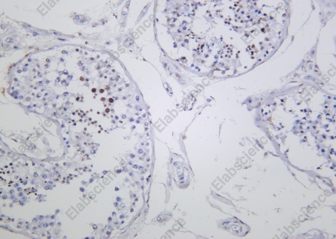 Recombinant Phospho-Histone H3 (Ser10, Thr11) Monoclonal Antibody - 2