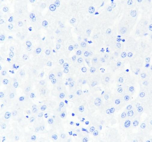 Recombinant ACTH Monoclonal Antibody - 3