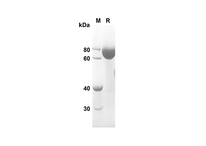 Recombinant Mouse CCL3 Protein(Fc Tag)-产品推荐-1