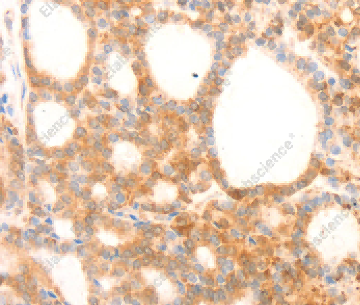 NAP1L1 Polyclonal Antibody - 3