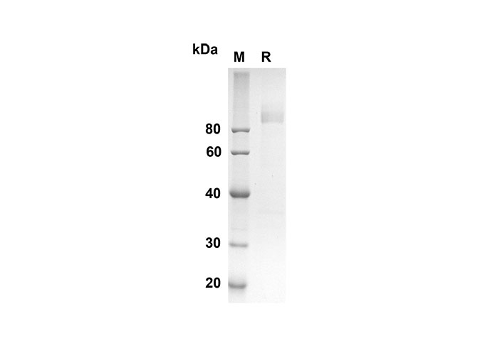 Recombinant Rat IL1A/IL-1F1 Protein(His Tag)-产品推荐-1