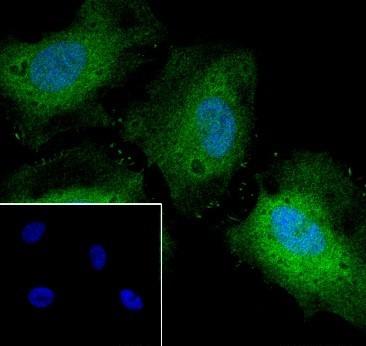 Recombinant Thymidylate Synthase Monoclonal Antibody-searchlist-2