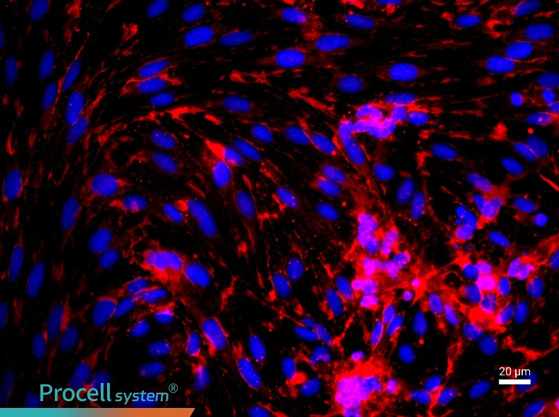 Rat Brain Microvascular Endothelial Cell Complete Medium - 2