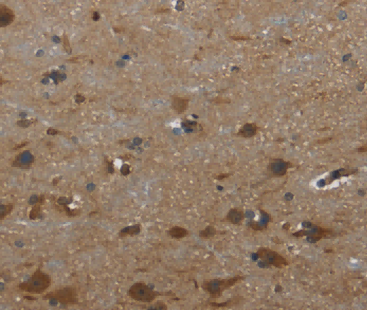 GYS1 Polyclonal Antibody - 3