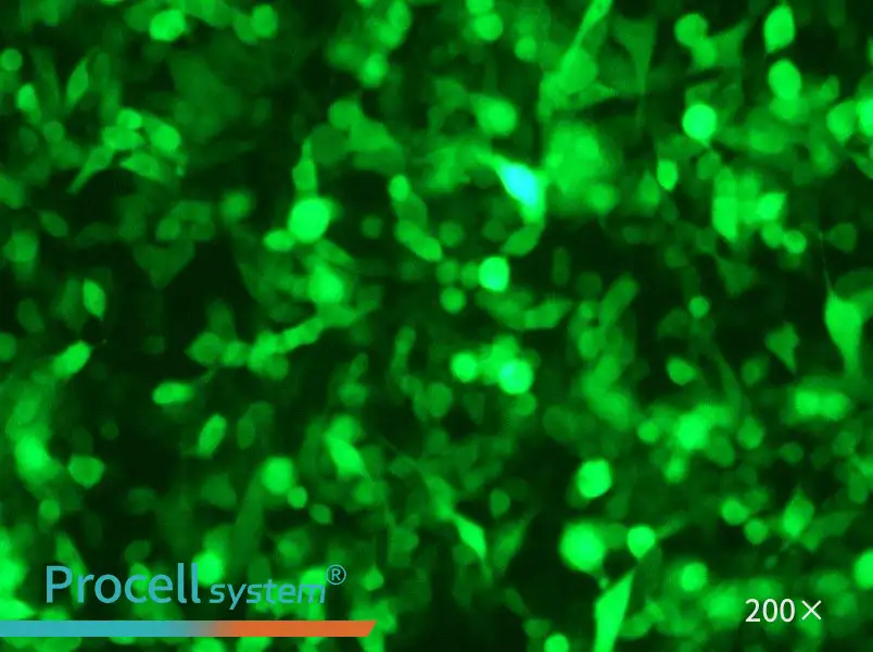 RM-1-GFP Cell Complete Medium - 5