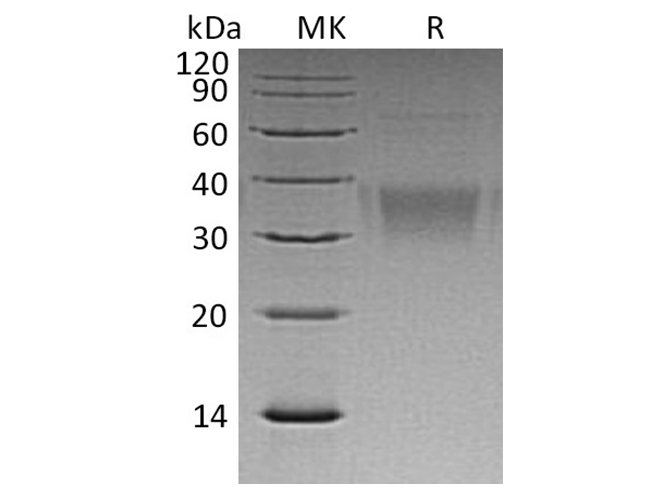 Recombinant Human Ephrin-B2/EFNB2 Protein (His Tag)(Active)