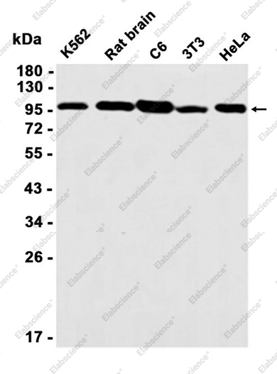 Recombinant alpha Actinin 4 Monoclonal Antibody - 1