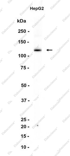 Recombinant Fibrinogen alpha chain Monoclonal Antibody - 1