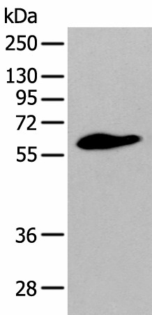 Western blot analysis of Human prostate tissue  using STEAP2 Polyclonal Antibody at dilution of 1:400