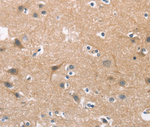 Immunohistochemistry of paraffin-embedded Human brain  tissue using CDC25B  Polyclonal Antibody at dilution 1:45