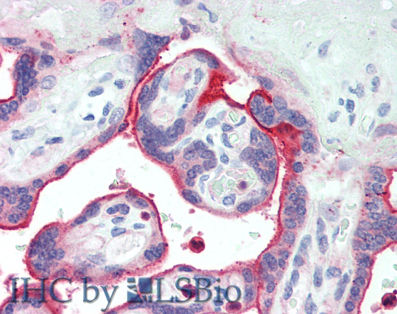 Immunohistochemistry of paraffin-embedded Human Placenta using NECTIN4 Polyclonal Antibody at dilution of 1:90(Elabscience Product Detected by Lifespan).