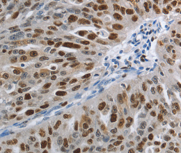 MCM3 Polyclonal Antibody - 3
