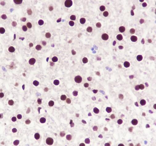 Recombinant NFIB Monoclonal Antibody - 3