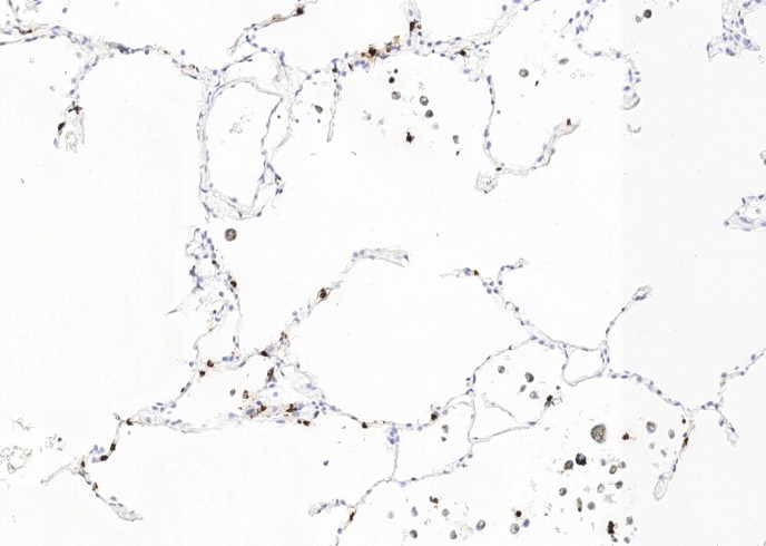 Recombinant Lipocalin-2/LCN2 Monoclonal Antibody - small - 2