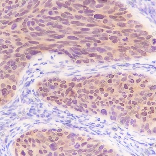 Recombinant S100A2 Monoclonal Antibody - 2