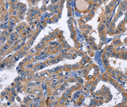 PKC delta Polyclonal Antibody - 3